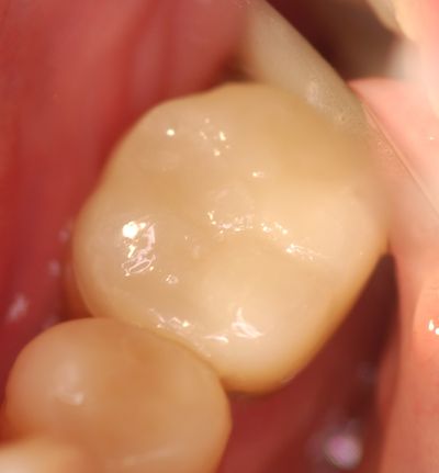 White Crowns