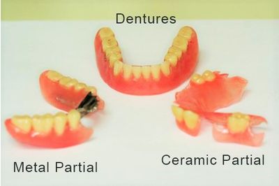 Denture Alternatives